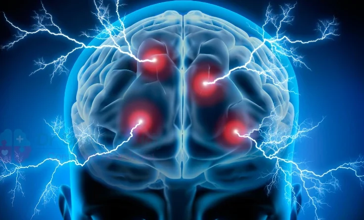 Doctor reviewing brain scan results for stroke diagnosis.